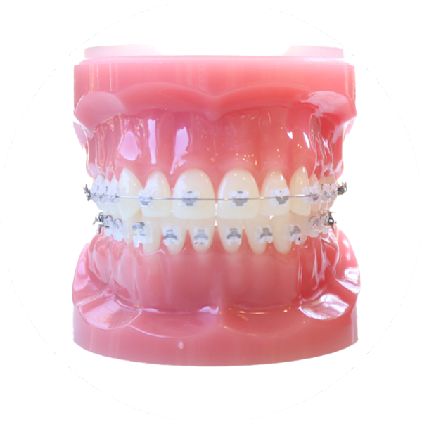 マウスピース型矯正装置